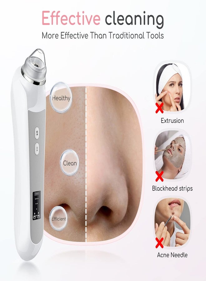 TTozka Blackhead Remover Vacuum, Black Head Remover for Face with Camera, Pore Vacuum for Men and Women, USB Interface Type Blackhead Remover Tools, 6 Suction Heads & 3 Adjustment Modes (Grey) - Image 4